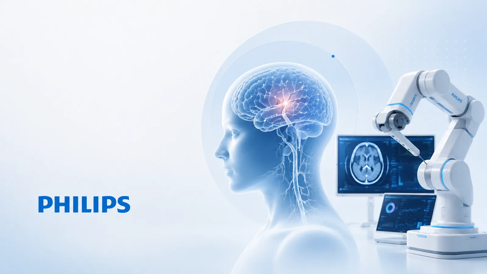 Philips desarrolla robots con IA para tratar accidentes cerebrovasculares